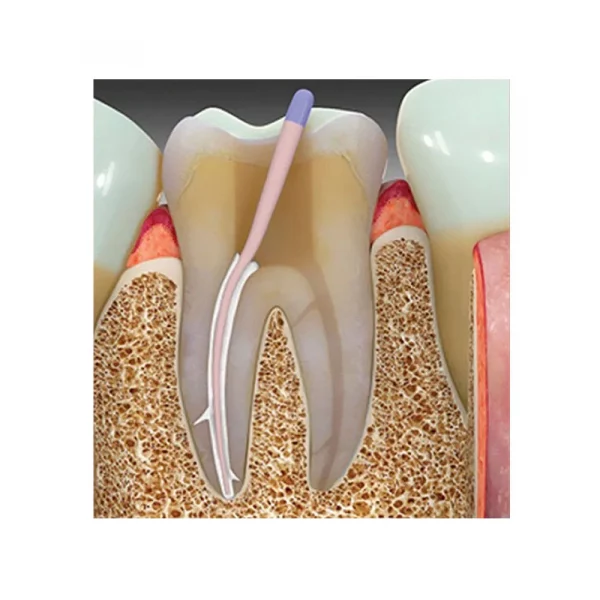 Prime Dental Bioceramic RCS